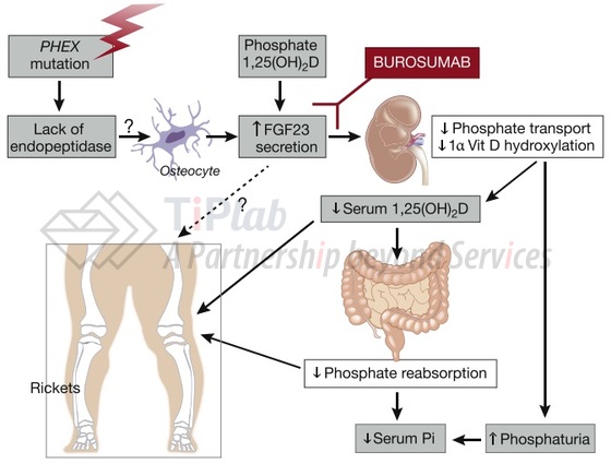 参见：Kidney Int. 2018 Nov;94(5):846-848.